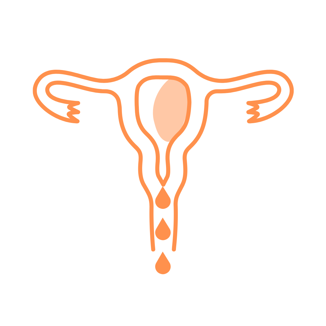 /build/_assets/endometriosis-0-D6EPK34J.png